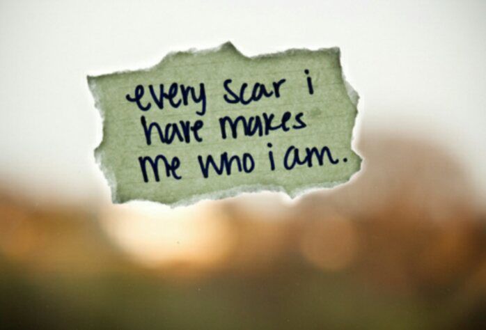 Lessons in Grief:  Displaying Our&nbsp;Scars